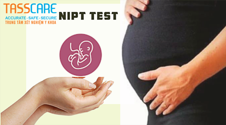Xét nghiệm Sàng lọc trước sinh NIPT - 23 Cặp nhiễm sắc thể 