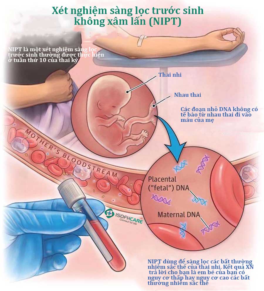 Xét nghiệm sàng lọc trước sinh không xâm lấn (NIPT)