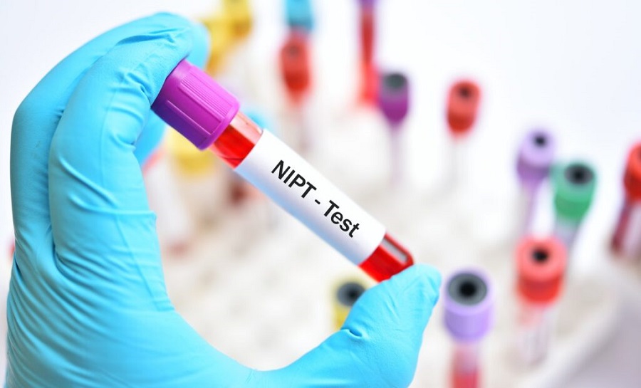 Sàng lọc trước sinh NIPT được sử dụng rộng rãi tại nhiều nước trên thế giới 