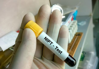 Xét nghiệm NIPT NIPT - ILLUMINA Cao cấp tại BVĐK Bảo Sơn