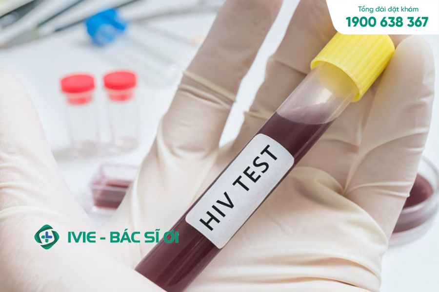 Xét nghiệm PCR HIV có quy trình ra sao?