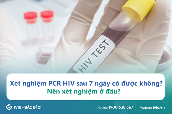 Xét nghiệm PCR HIV sau 7 ngày có được không? Nên xét nghiệm ...