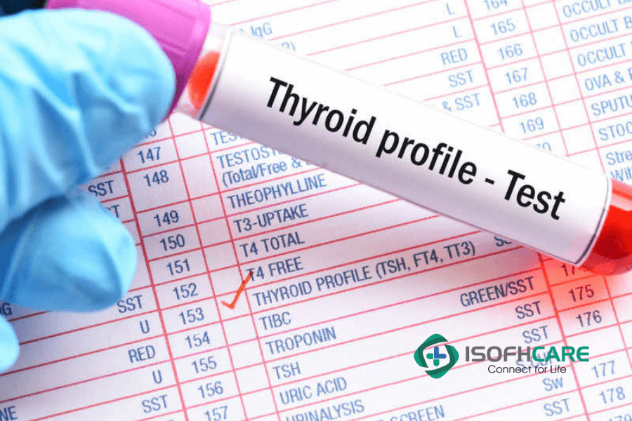 Kết quả xét nghiệm định lượng nồng độ T4 trong máu được đánh giá một cách khách quan nhất.