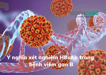 Ý nghĩa xét nghiệm HBsAb trong bệnh viêm gan B