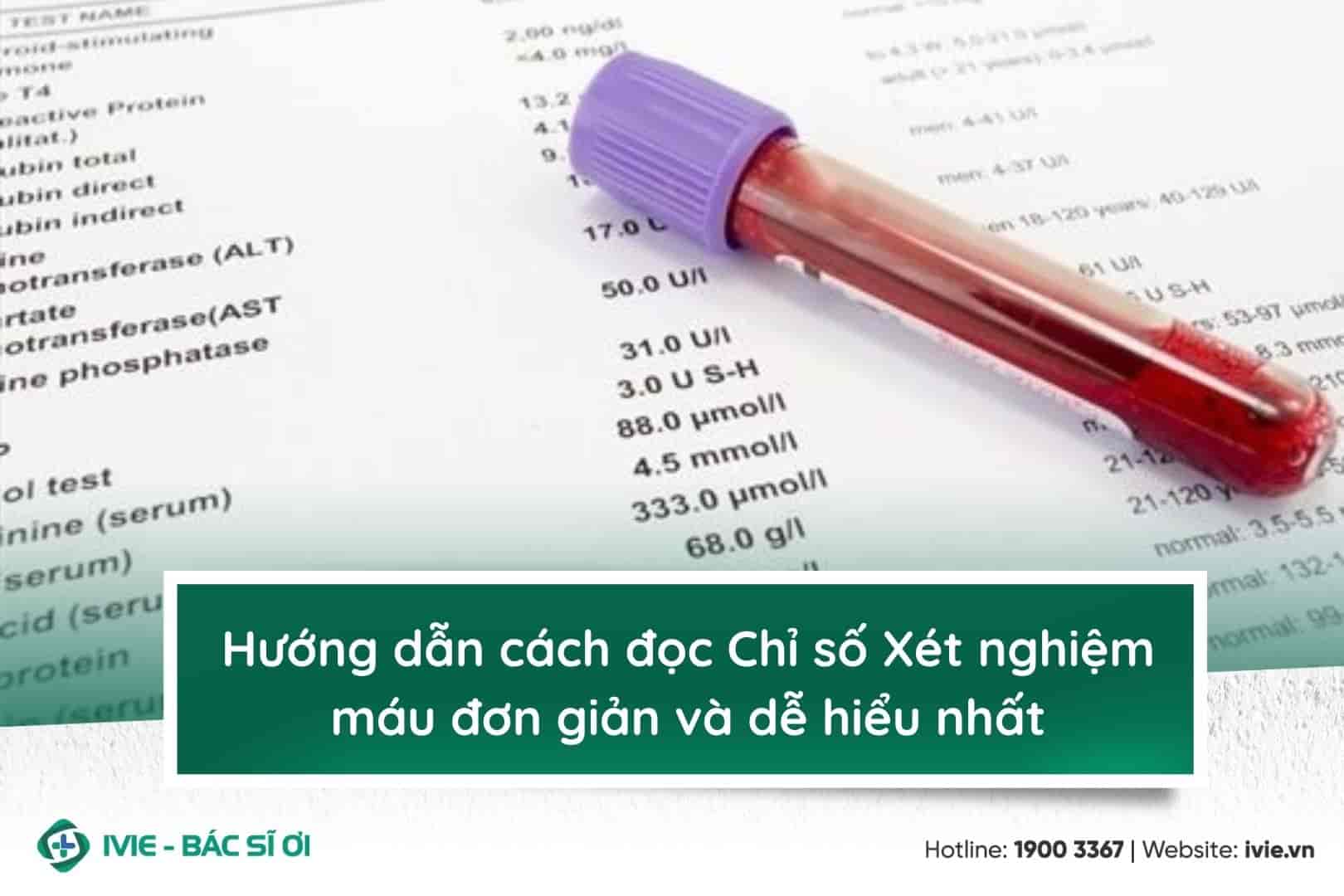 Hướng dẫn cách đọc Chỉ số Xét nghiệm máu đơn giản và dễ...