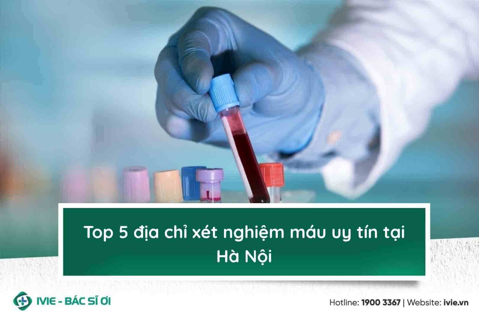 Top 5 địa chỉ xét nghiệm máu uy tín tại Hà Nội