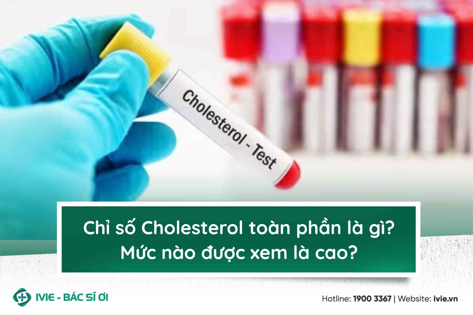 Chỉ số Cholesterol toàn phần là gì? Mức bao nhiêu được xem...