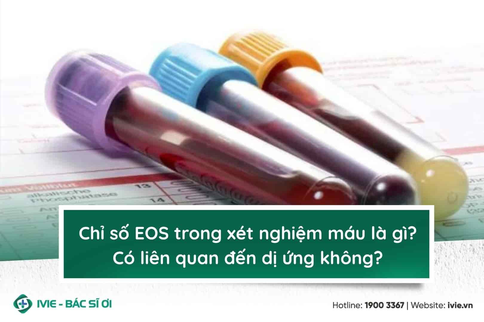 Chỉ số EOS trong xét nghiệm máu là gì? Có liên quan đến dị...