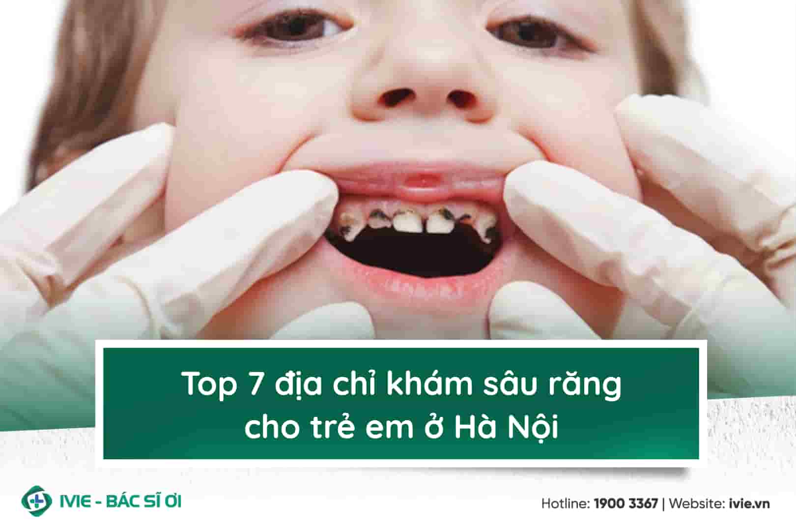 Top 7 địa chỉ khám sâu răng cho trẻ em ở Hà Nội