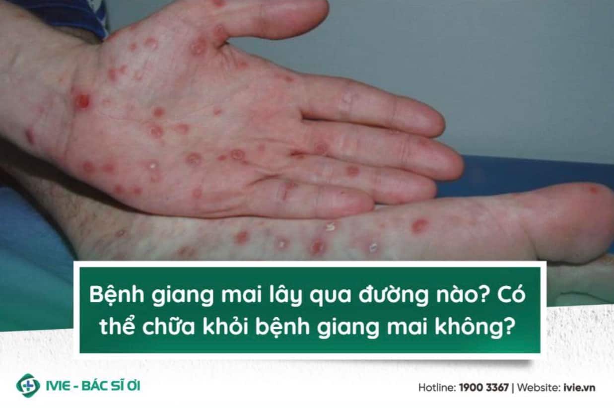 Bệnh giang mai lây qua đường nào? Có thể chữa khỏi bệnh...
