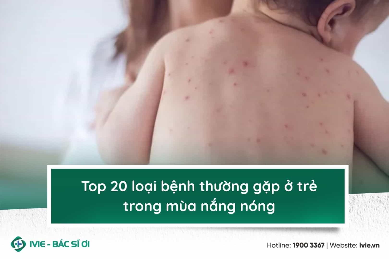 Top 20 loại bệnh thường gặp ở trẻ trong mùa nắng nóng