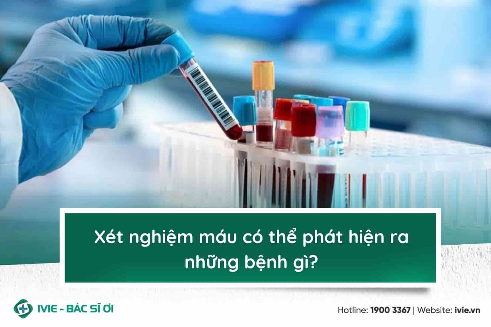 Xét nghiệm máu có thể phát hiện ra những bệnh gì?