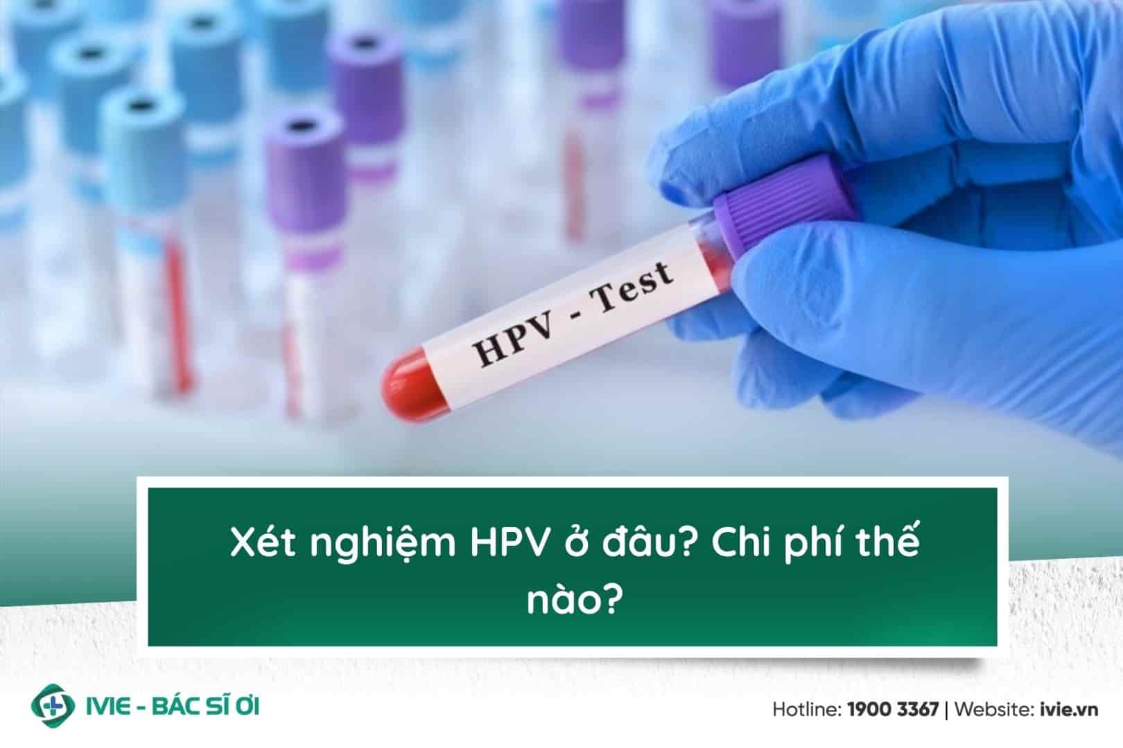 Xét nghiệm HPV ở đâu? Chi phí thế nào?