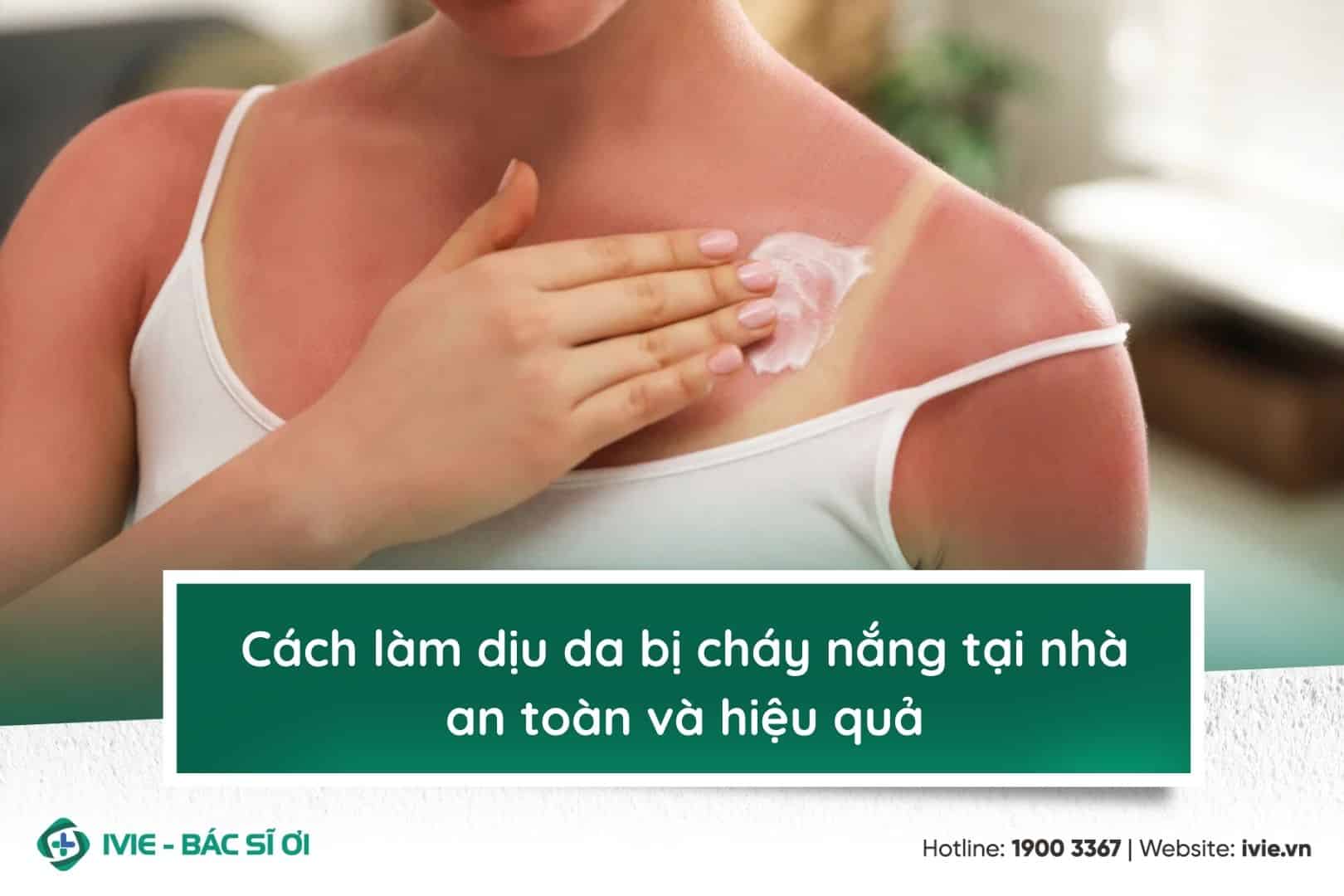 Cách làm dịu da bị cháy nắng tại nhà an toàn và hiệu quả