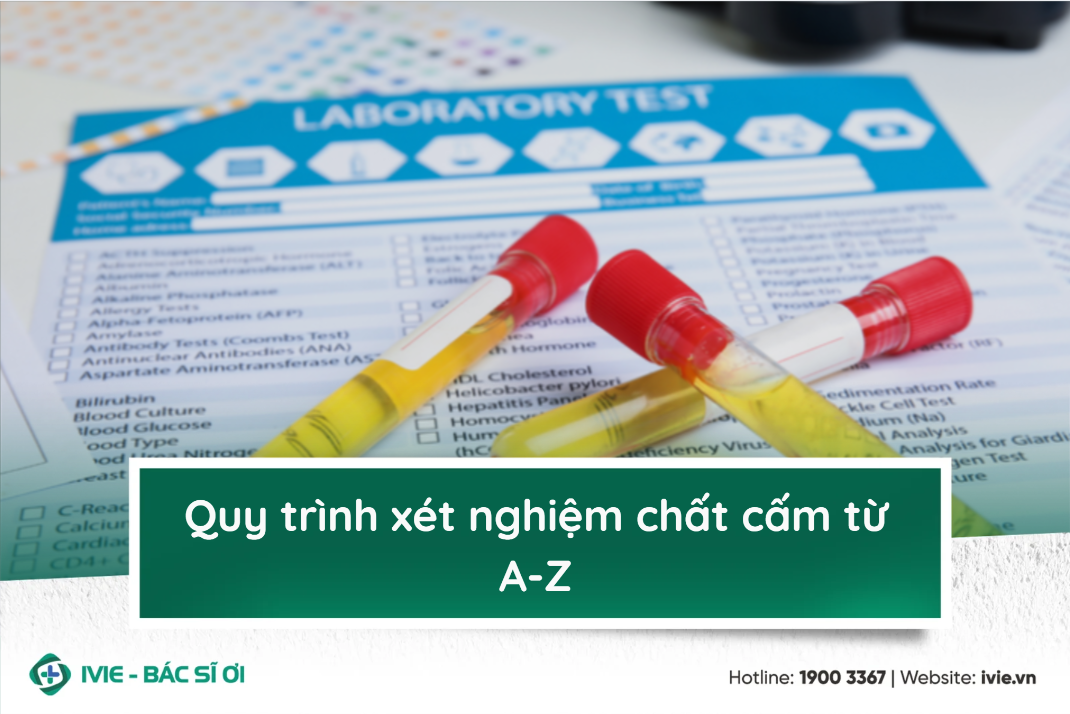 Quy trình xét nghiệm chất cấm từ A-Z