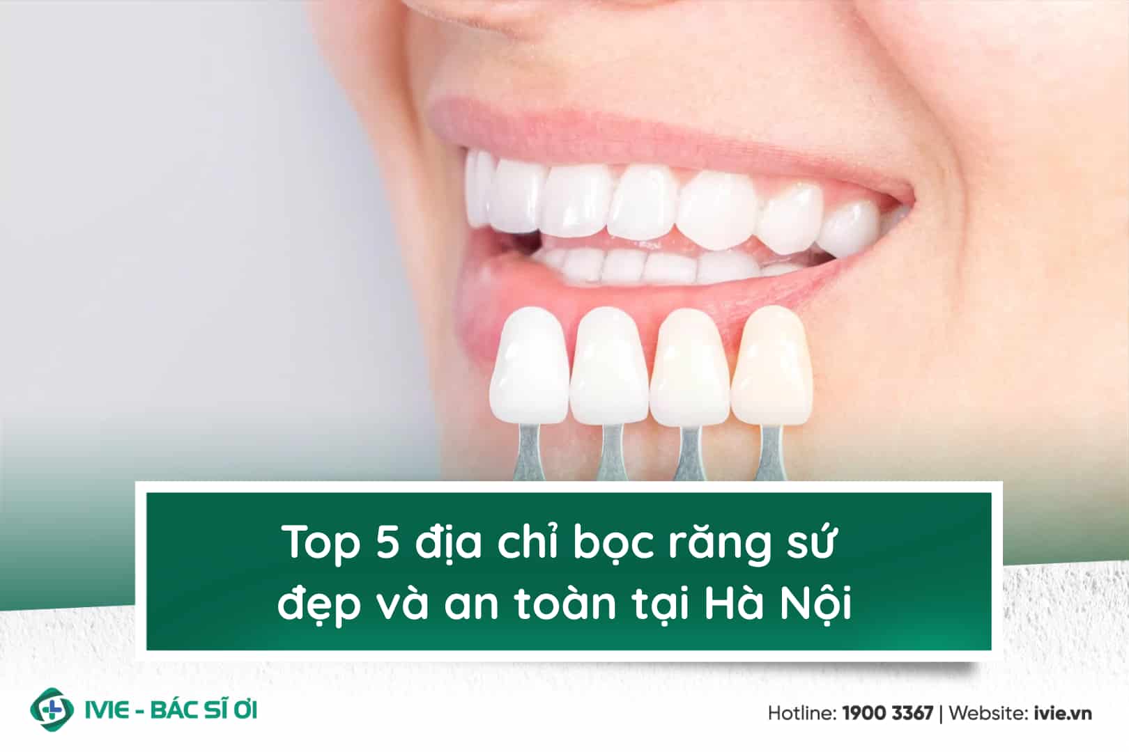 Top 5 địa chỉ bọc răng sứ đẹp và an toàn tại Hà Nội