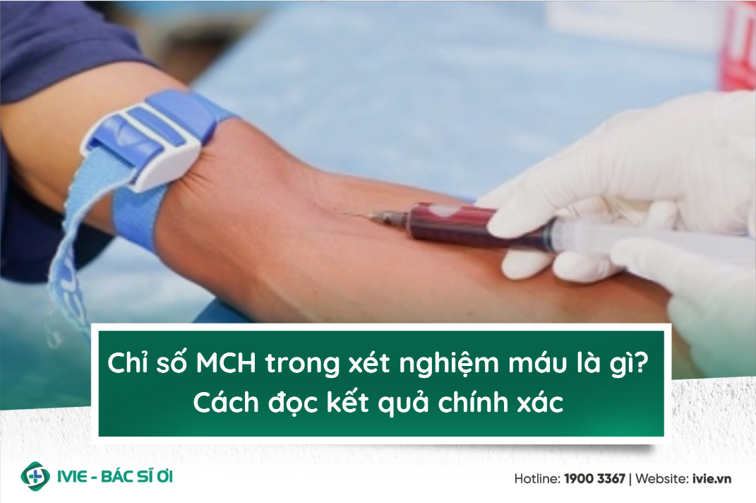 Chỉ số MCH trong xét nghiệm máu là gì? Cách đọc kết quả...