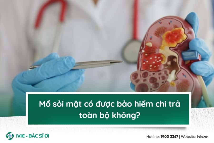 Mổ sỏi mật có được bảo hiểm chi trả toàn bộ không?
