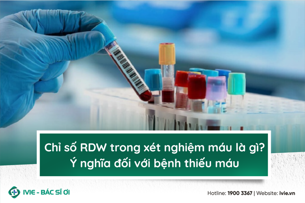 Chỉ số RDW trong xét nghiệm máu là gì? Ý nghĩa đối với bệnh ...