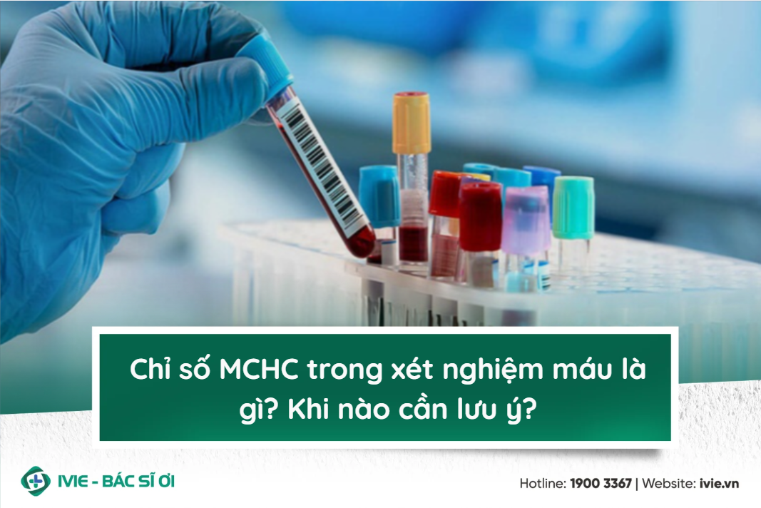 Chỉ số MCHC trong xét nghiệm máu là gì? Khi nào cần lưu ý?