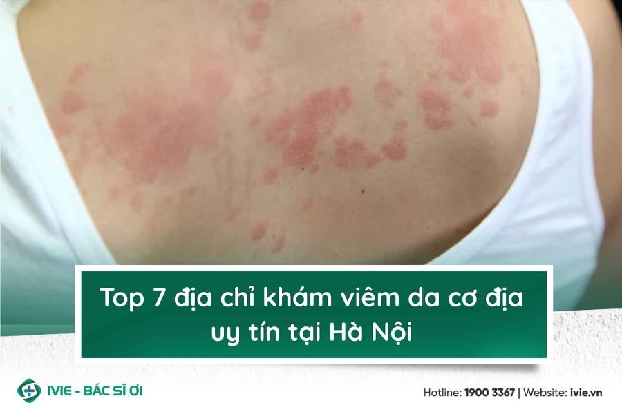 Top 7 địa chỉ khám viêm da cơ địa uy tín tại Hà Nội