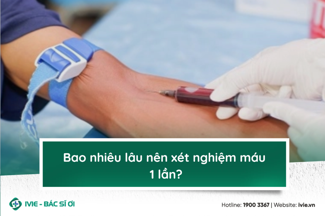 Bao nhiêu lâu nên xét nghiệm máu 1 lần?