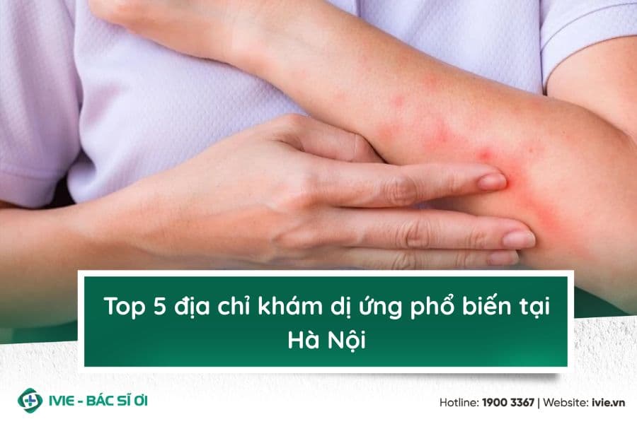 Top 5 địa chỉ khám dị ứng phổ biến tại Hà Nội