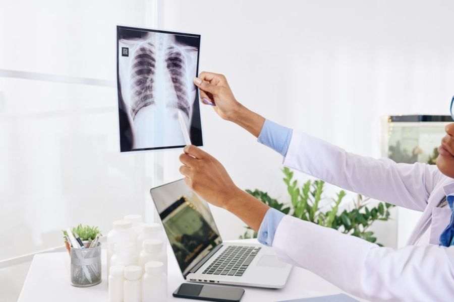 Chụp X-quang là kỹ thuật chẩn đoán hình ảnh sử dụng tia X để quan sát cấu trúc bên trong cơ thể