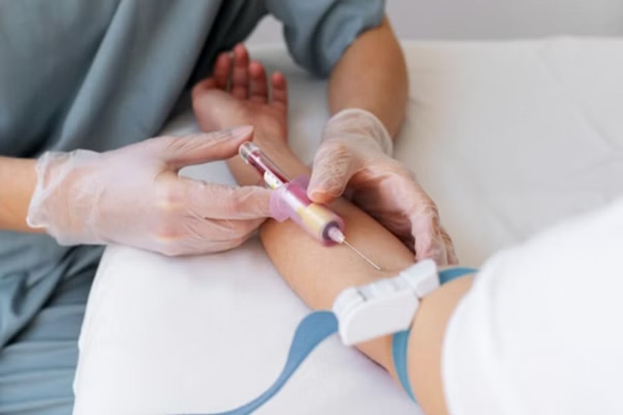 Mức hỗ trợ chi phí xét nghiệm mỡ máu phụ thuộc vào quyền lợi BHYT của từng người