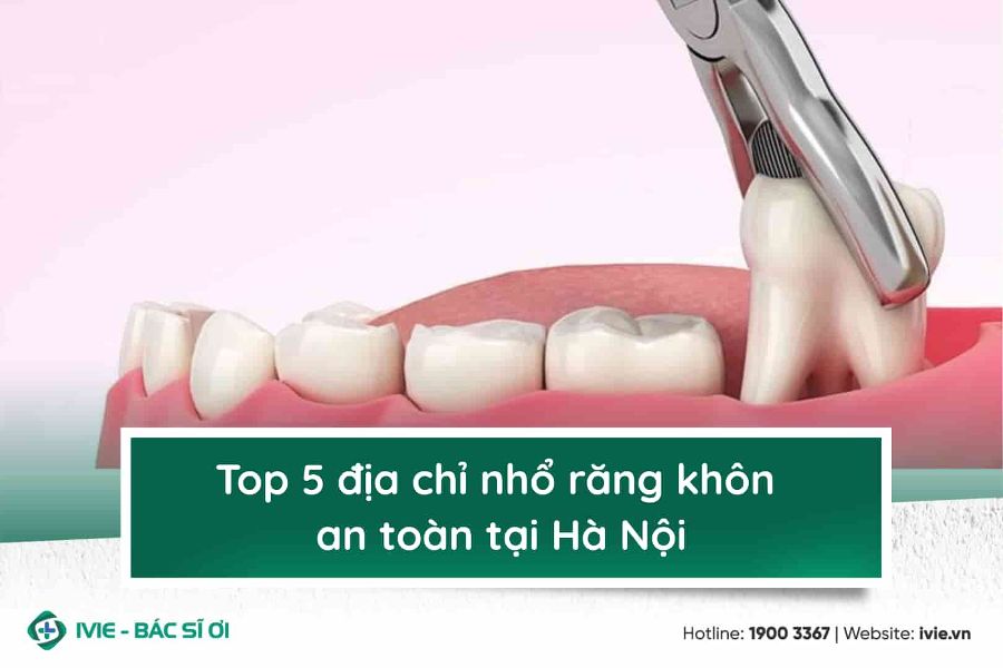 Top 7 địa chỉ nhổ răng khôn an toàn tại Hà Nội