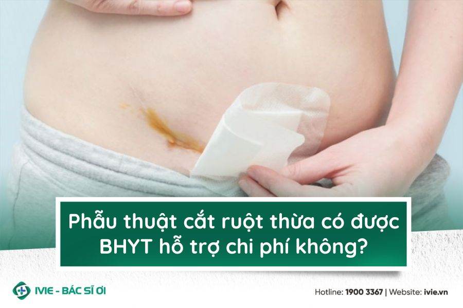 Phẫu thuật cắt ruột thừa có được BHYT hỗ trợ chi phí không?