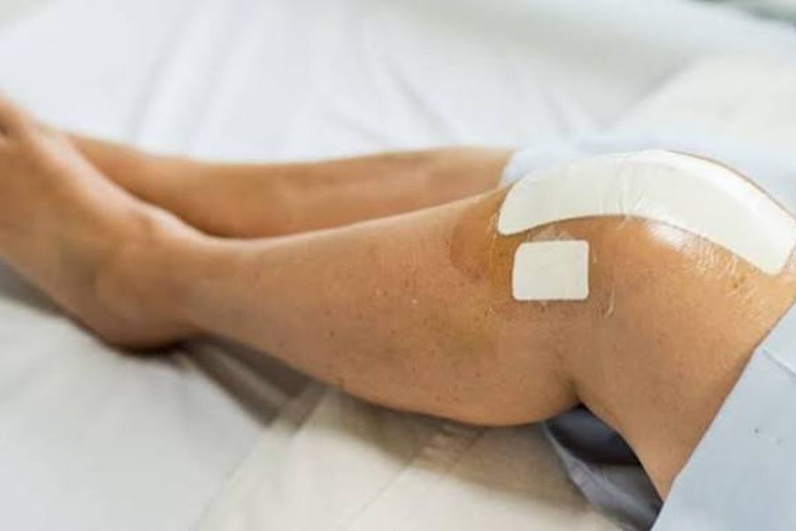 Nội soi khớp gối nằm trong danh mục được BHYT thanh toán