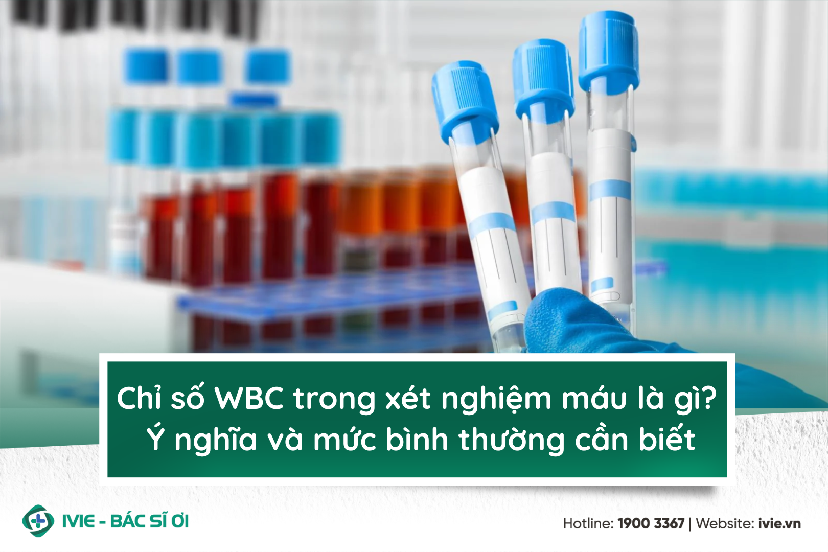 Chỉ số WBC trong xét nghiệm máu là gì? Cảnh báo điều gì về...