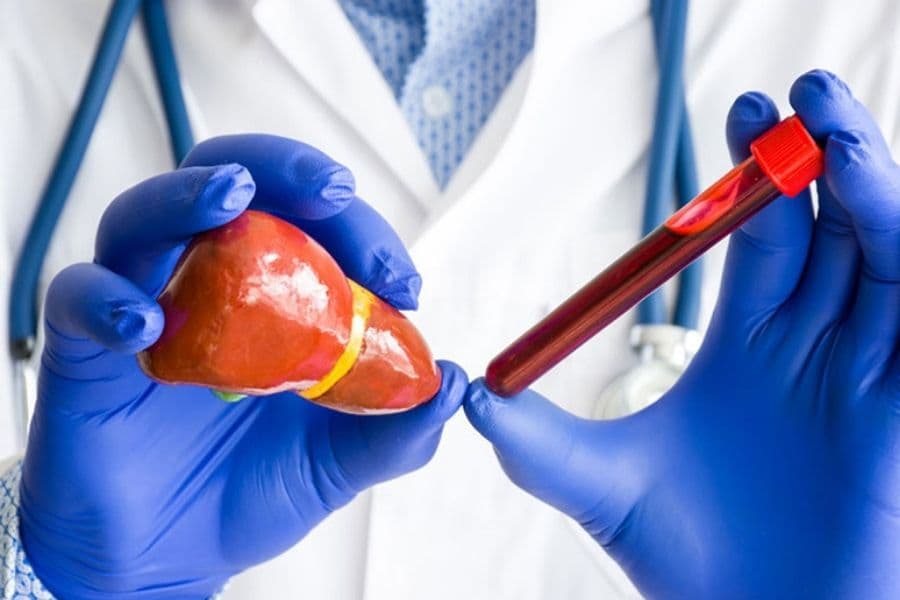 BHYT hỗ trợ xét nghiệm chức năng gan phục vụ chẩn đoán và điều trị theo chỉ định của bác sĩ