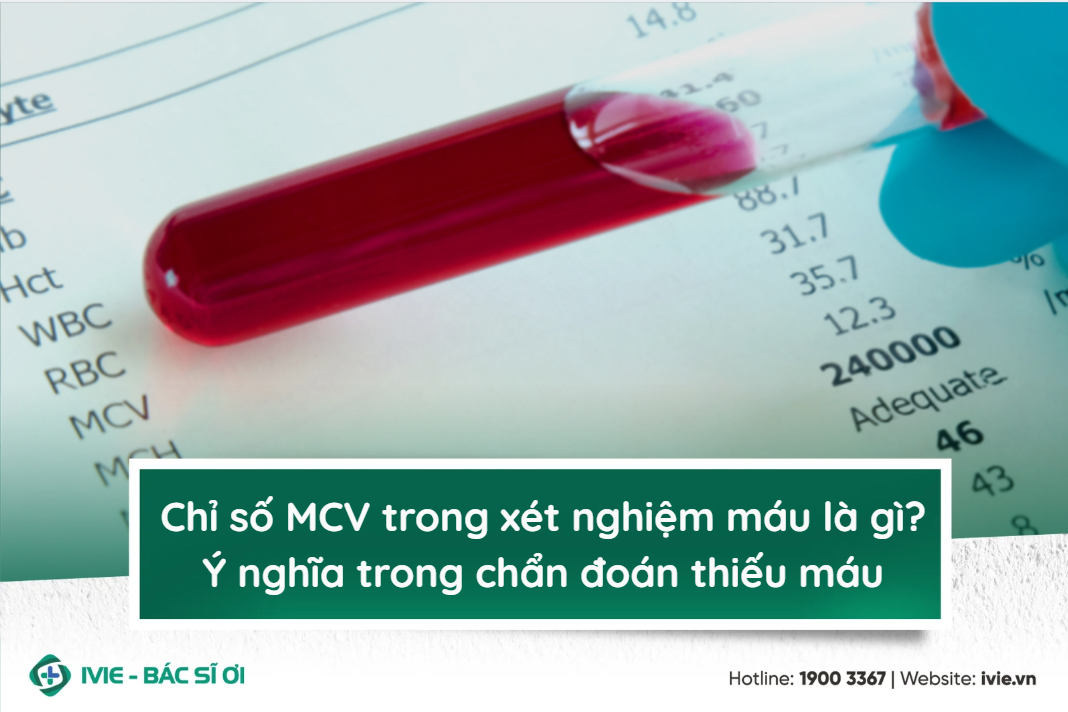 Chỉ số MCV trong xét nghiệm máu là gì? Ý nghĩa trong chẩn...