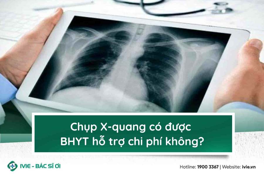 Chụp X-quang có được BHYT hỗ trợ chi phí không?