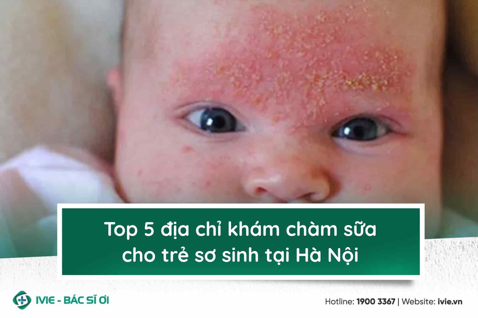 Top 5 địa chỉ khám chàm sữa cho trẻ sơ sinh tại Hà Nội