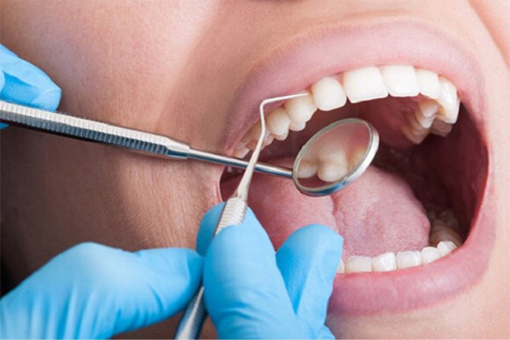 Một số dịch vụ chăm sóc và điều trị răng miệng tại Imperia
