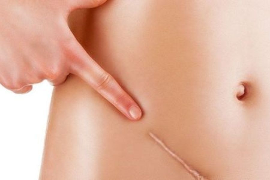 BHYT chỉ thanh toán các chi phí thuộc danh mục được Quỹ BHYT quy định