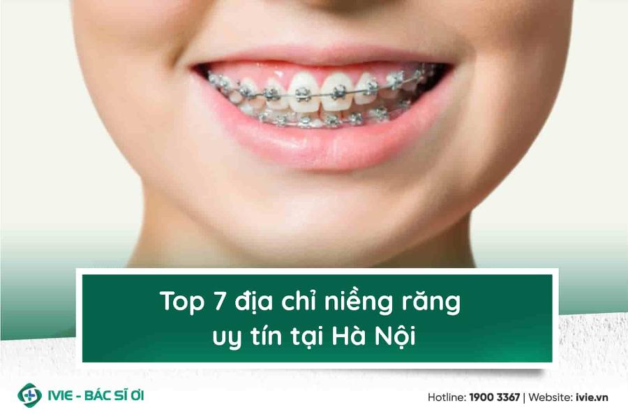 Top 7 địa chỉ niềng răng uy tín tại Hà Nội