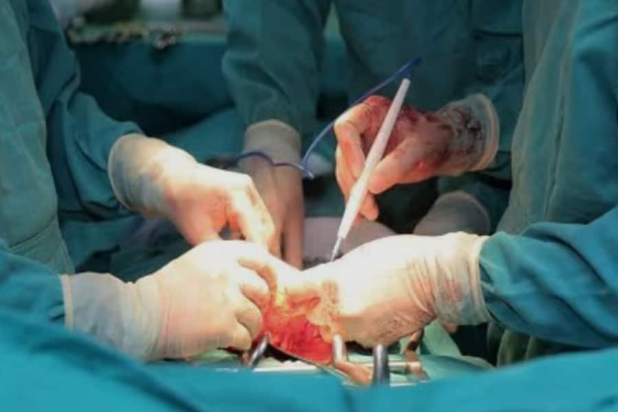 Các trường hợp phẫu thuật dạ dày nhằm mục đích thẩm mỹ hoặc giảm béo cho người béo phì sẽ không được bảo hiểm y tế chi trả