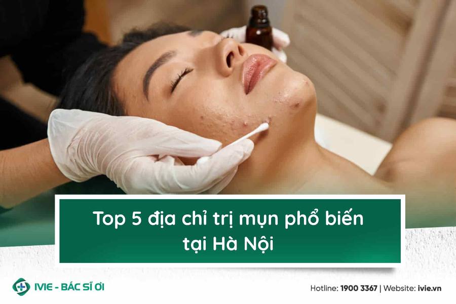 Top 7 địa chỉ trị mụn tại Hà Nội