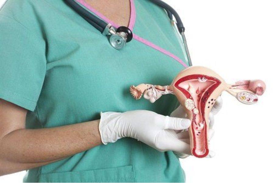 Mức hưởng BHYT khi phẫu thuật u nang buồng trứng phụ thuộc vào nhóm đối tượng tham gia và hình thức khám chữa bệnh